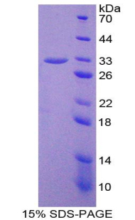 Recombinant Nucleoporin 37 (NUP37)