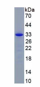 Recombinant Coagulation Factor XIII A1 Polypeptide (F13A1)