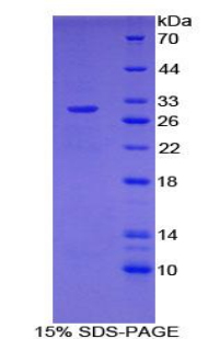 Recombinant Nucleoporin 107kDa (NUP107)