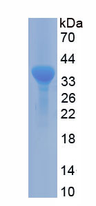Recombinant Arginase (ARG)