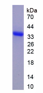 Recombinant Deoxyribonuclease I (DNASE1)