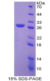 Recombinant Leukocyte Immunoglobulin Like Receptor Subfamily B, Member 2 (LILRB2)