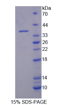 Recombinant Nucleoporin 214kDa (NUP214)