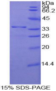 Recombinant Nucleoporin 205kDa (NUP205)