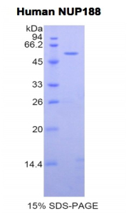 Recombinant Nucleoporin 188kDa (NUP188)