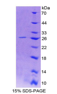 Recombinant Asialoglycoprotein Receptor 1 (ASGR1)