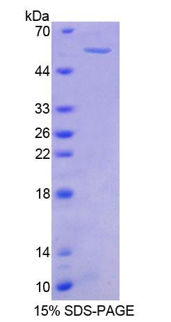 Recombinant Protein Tyrosine Kinase 2 Beta (PYK2)