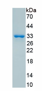 Recombinant Microtubule Associated Protein 6 (MAP6)