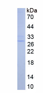 Recombinant 15-Lipoxygenase-2 (15-LO-2)