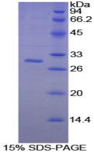 Recombinant Platelet Activating Factor Acetylhydrolase Ib3 (PAFAH1B3)