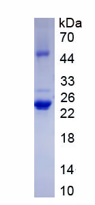 Recombinant Integrin Alpha E (ITGaE)