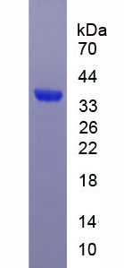 Recombinant Early Growth Response Protein 2 (EGR2)