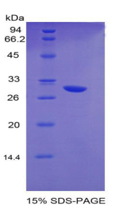 Recombinant Early Growth Response Protein 2 (EGR2)