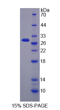 Recombinant Poliovirus Receptor Related Protein 3 (PVRL3)