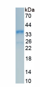 Recombinant Collectin Liver 1 (CLL1)