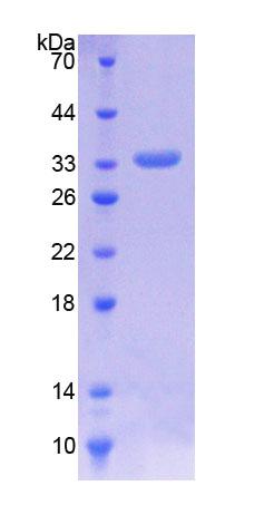 Recombinant Integrin Linked Kinase (ILK)