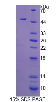 Recombinant Cytohesin 4 (CYTH4)