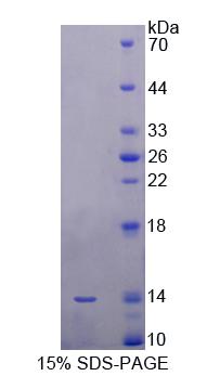 Recombinant Signal Recognition Particle 9kDa (SRP9)