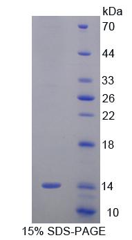 Recombinant Signal Recognition Particle 9kDa (SRP9)