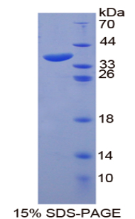 Recombinant Ankyrin 1, Erythrocytic (ANK1)