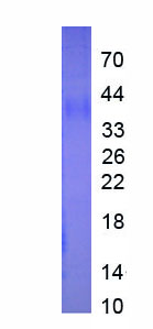 Recombinant Interleukin 13 Receptor Alpha 2 (IL13Ra2)