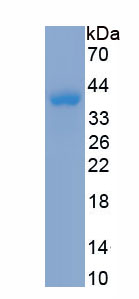 Recombinant Cytokeratin 10 (CK10)