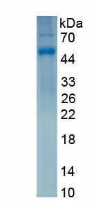 Recombinant Alpha-1-Antitrypsin (a1AT)