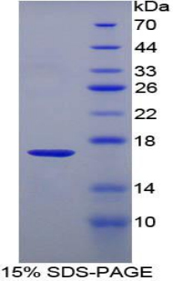 Recombinant T-Cell Leukemia/Lymphoma Protein 1A (TCL1A)