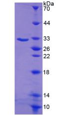 Recombinant Serum/Glucocorticoid Regulated Kinase 1 (SGK1)