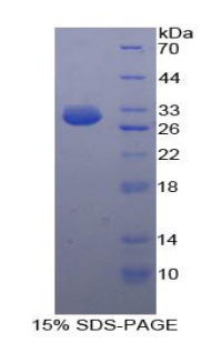 Recombinant Hexokinase 3, White Cell (HK3)
