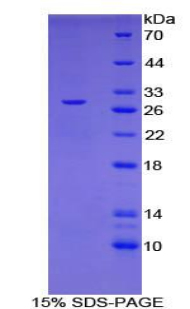 Recombinant Dihydropyrimidinase Like Protein 3 (DPYSL3)