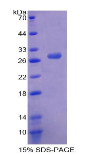 Recombinant Myeloid Cell Nuclear Differentiation Antigen (MNDA)