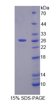 RPB857Hu01.jpg