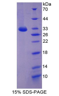 Recombinant Mitogen Activated Protein Kinase 10 (MAPK10)