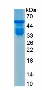 Recombinant Coagulation Factor VII (F7)