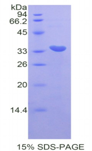 Recombinant Cyclin Dependent Kinase 7 (CDK7)