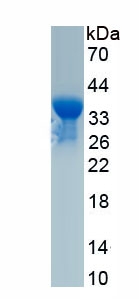 Recombinant Eukaryotic Translation Initiation Factor 3A (EIF3A)