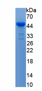 Recombinant Interleukin 7 Receptor (IL7R)