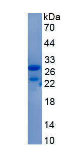 Recombinant Syndecan 4 (SDC4)