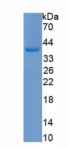 Recombinant Histone Acetyltransferase 1 (HAT1)