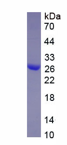 Recombinant Inhibitor Of Nuclear Factor Kappa B Kinase Interacting Protein (IKBIP)