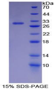 Recombinant Inhibitor Of Nuclear Factor Kappa B Kinase Interacting Protein (IKBIP)