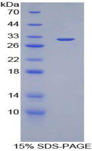 Recombinant Inhibitor Of Nuclear Factor Kappa B Kinase Interacting Protein (IKBIP)