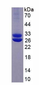 Recombinant Interferon Regulatory Factor 6 (IRF6)