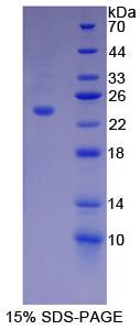 Recombinant Dynamin 1 (DNM1)