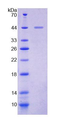 Recombinant Sodium Hydrogen Exchange Regulatory Cofactor 2 (SLC9A3R2)