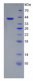 Recombinant Sodium Hydrogen Exchange Regulatory Cofactor 2 (SLC9A3R2)