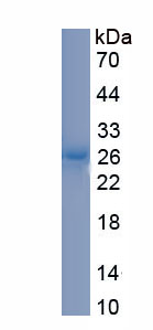 Recombinant Apolipoprotein C2 (APOC2)