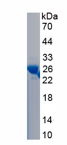 Recombinant Large Neutral Amino Acid Transporter 1 (LAT1)