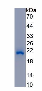 Recombinant Aldehyde Dehydrogenase, Mitochondrial (ALDH2)